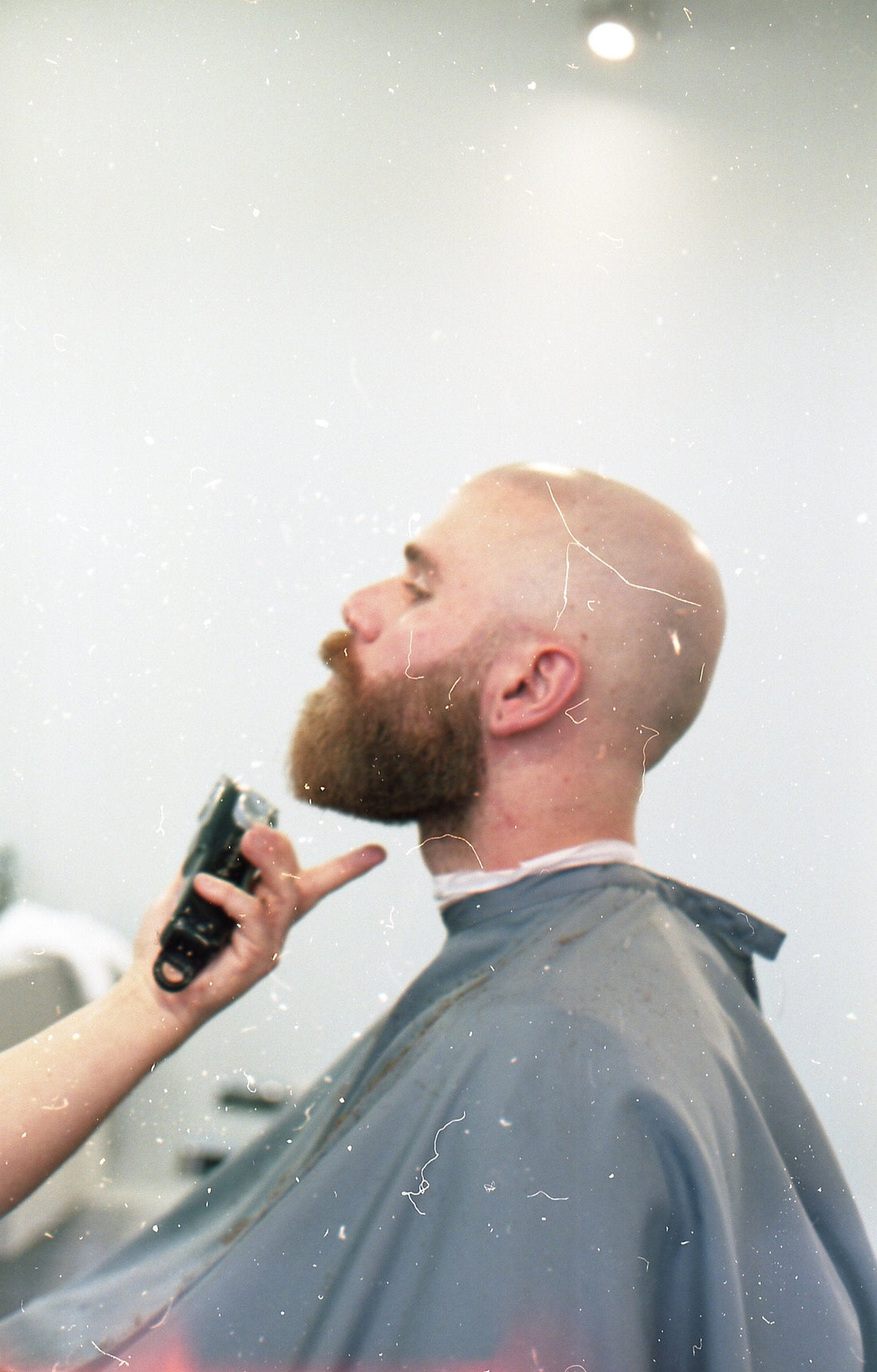 How to go bald like a champion